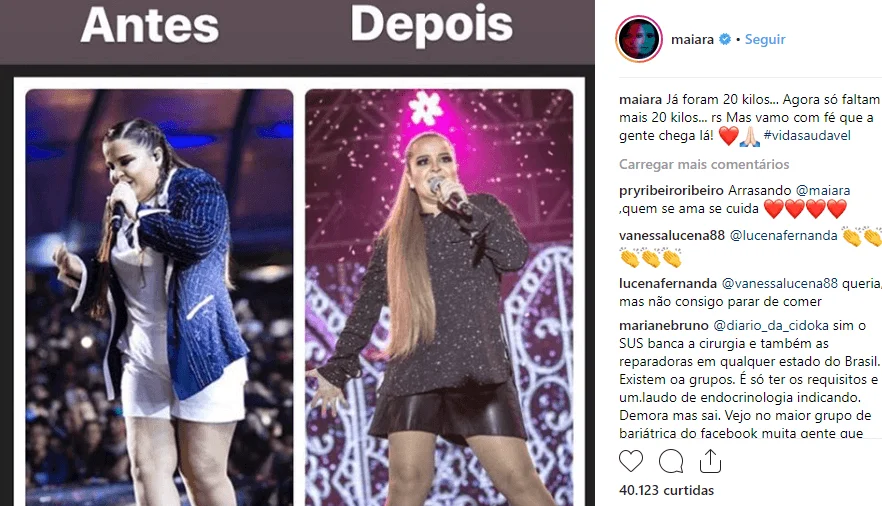 Celebs que, como Fausto Silva e André Marques, optaram pela bariátrica