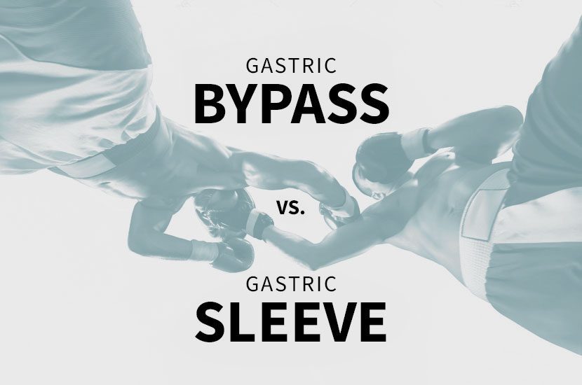 Bypass Gástrico X  Sleeve: qual técnica é melhor para você? Descubra