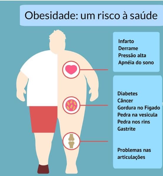 OBESIDADE