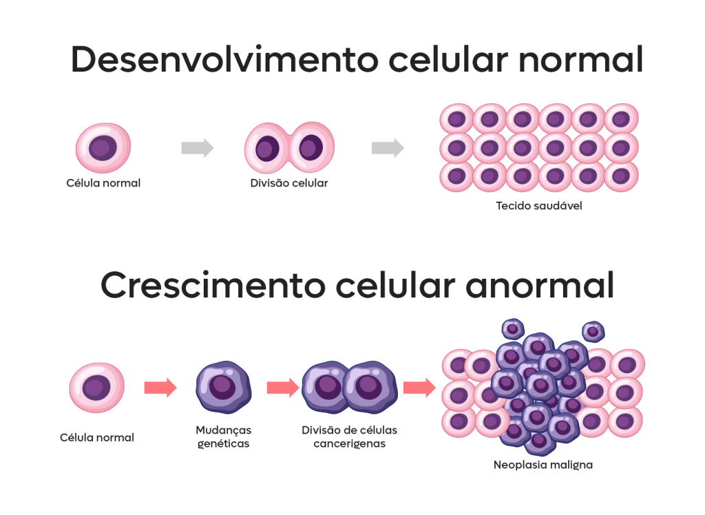 Neoplasias: esquema de desenvolvimento celular normal e anormal