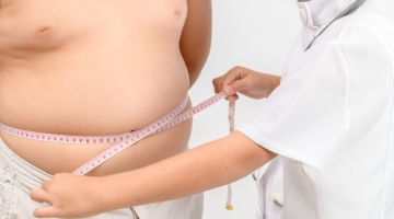 Cirurgia bariátrica e metabólica e efeito platô