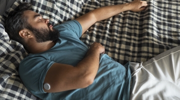 CIRURGIA BARIÁTRICA E METABÓLICA E APNEIA DO SONO