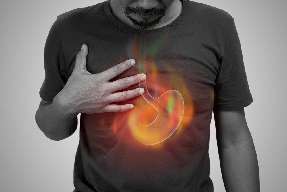 DIFERENÇA ENTRE REFLUXO GASTROESOFÁGICO E GASTRITE